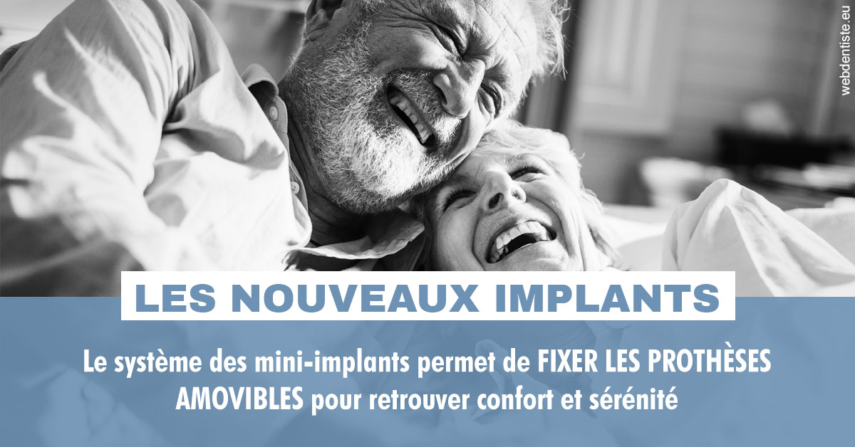 https://dr-clot-didier.chirurgiens-dentistes.fr/Les nouveaux implants 2
