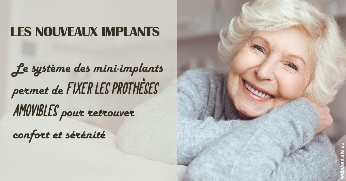 https://dr-clot-didier.chirurgiens-dentistes.fr/Les nouveaux implants 1