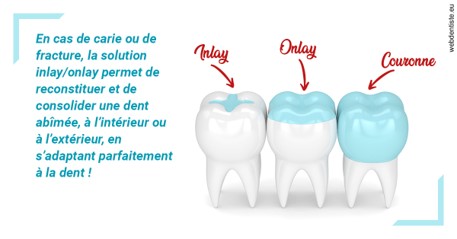 https://dr-clot-didier.chirurgiens-dentistes.fr/L'INLAY ou l'ONLAY
