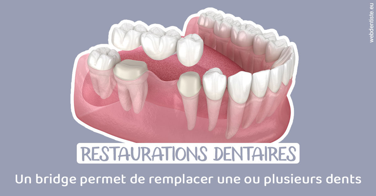 https://dr-clot-didier.chirurgiens-dentistes.fr/Bridge remplacer dents 1