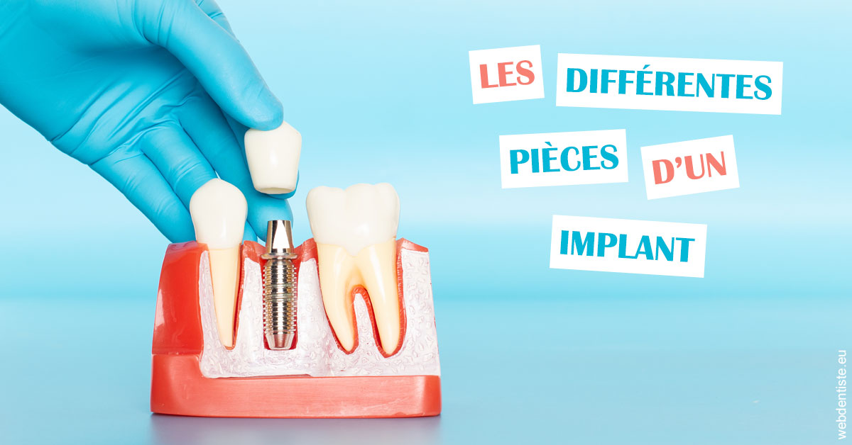 https://dr-clot-didier.chirurgiens-dentistes.fr/Les différentes pièces d’un implant 2