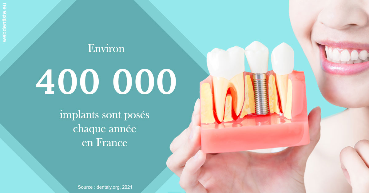 https://dr-clot-didier.chirurgiens-dentistes.fr/Pose d'implants en France 2