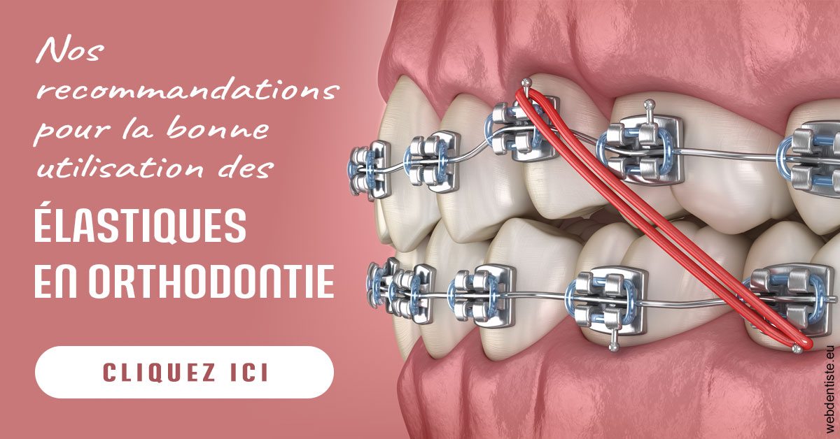 https://dr-clot-didier.chirurgiens-dentistes.fr/Elastiques orthodontie 2